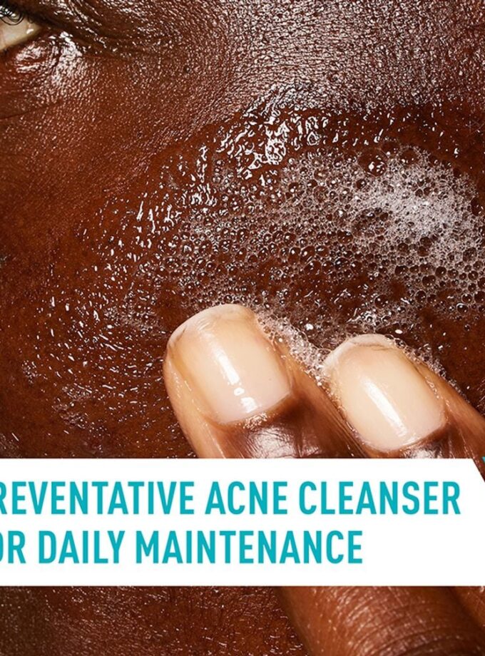 Cerave Acne Control Cleanser