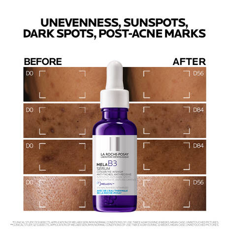 La Roche b3 Serum