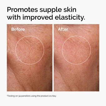 ord-hyaluronic-acid-2pct-b5-hydrating-serum-before-after-elasticity